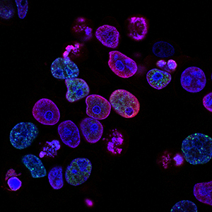 Human colorectal cancer cells treated with a topoisomerase inhibitor and an inhibitor of the protein kinase ATR (ataxia telangiectasia and Rad3 related), a drug combination under study as a cancer therapy. Cell nuclei are stained blue; the chromosomal protein histone gamma-H2AX marks DNA damage in red and foci of DNA replication in green. Created by Yves Pommier, Rozenn Josse, 2014. Photo by National Cancer Institute on Unsplash 